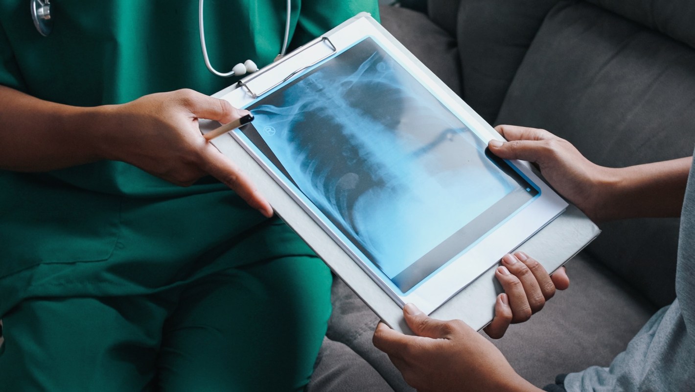 These findings suggest that those with asthma and COPD have a heightened response.