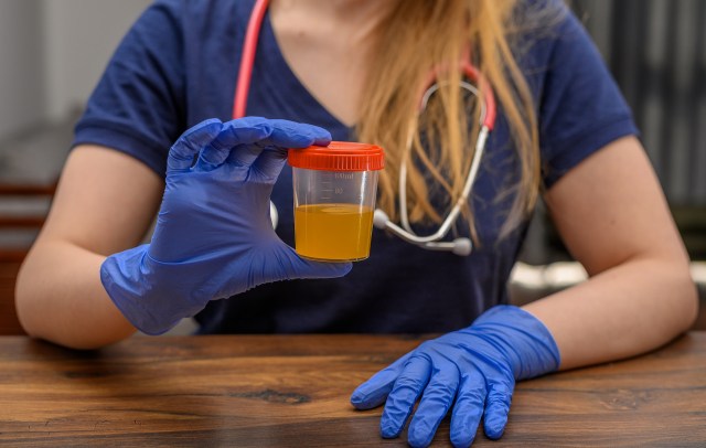To test their theory, the researchers gathered urine from waterless urinals.
