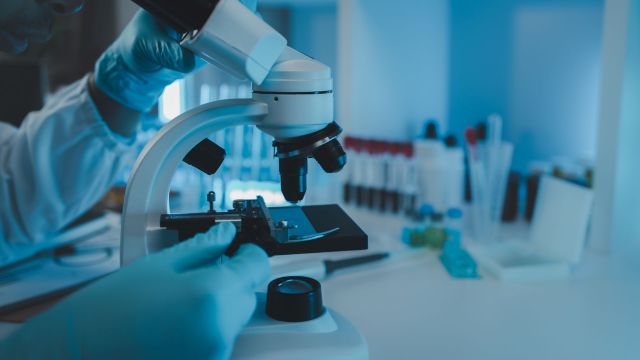 "Nobody knows for sure why colorectal cancer numbers are rising in young people."