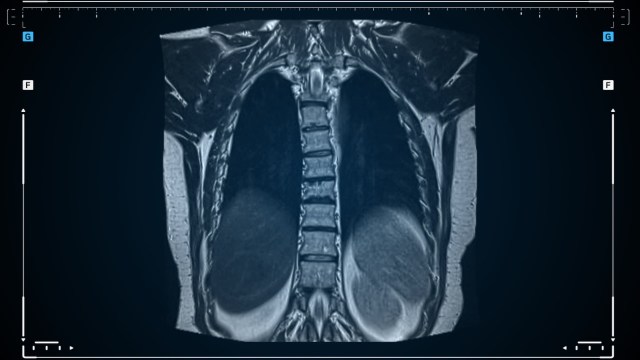 "All processes that are considered early indicators of cancer development."