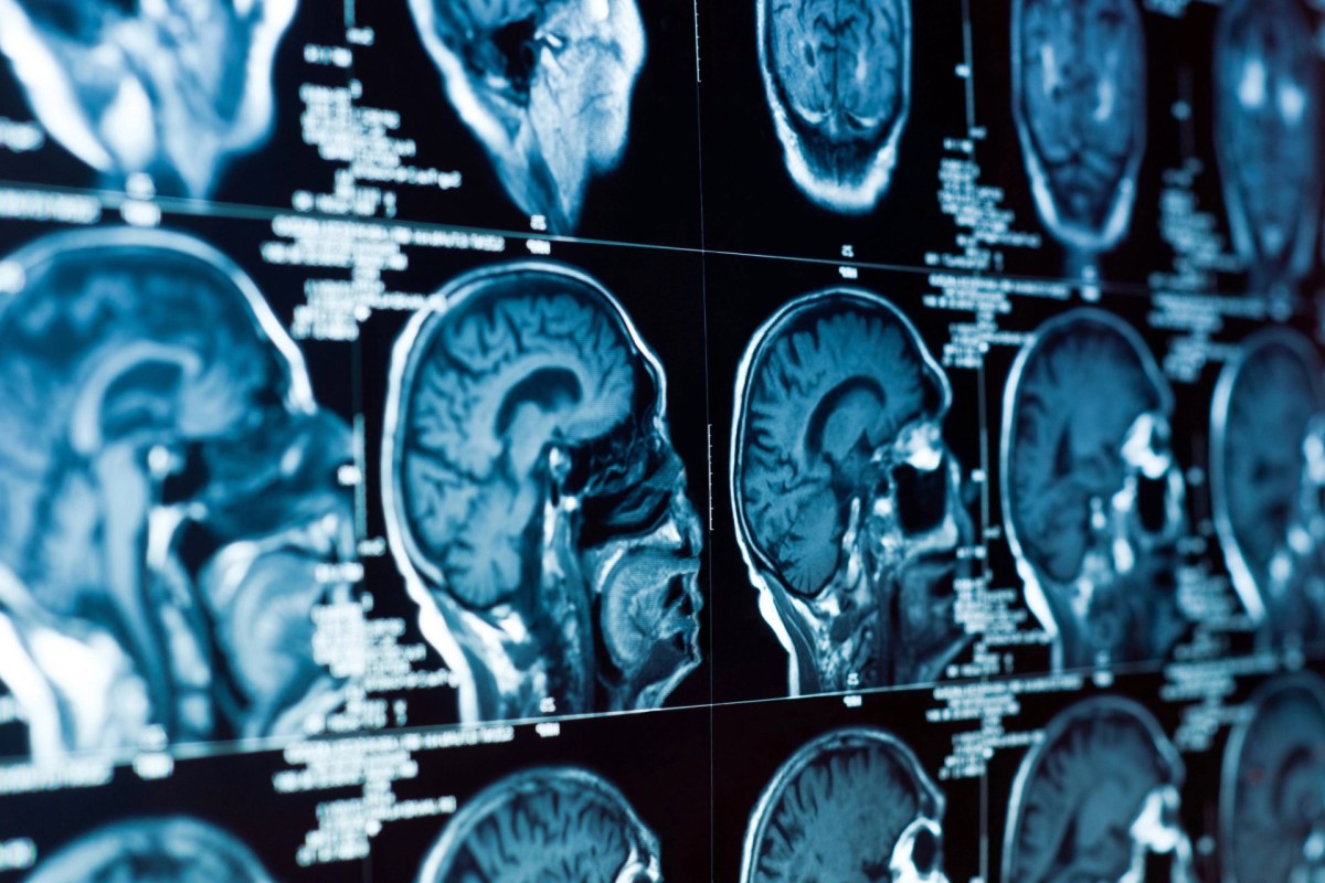 This raises serious concerns about long-term effects on memory, mood, and learning.